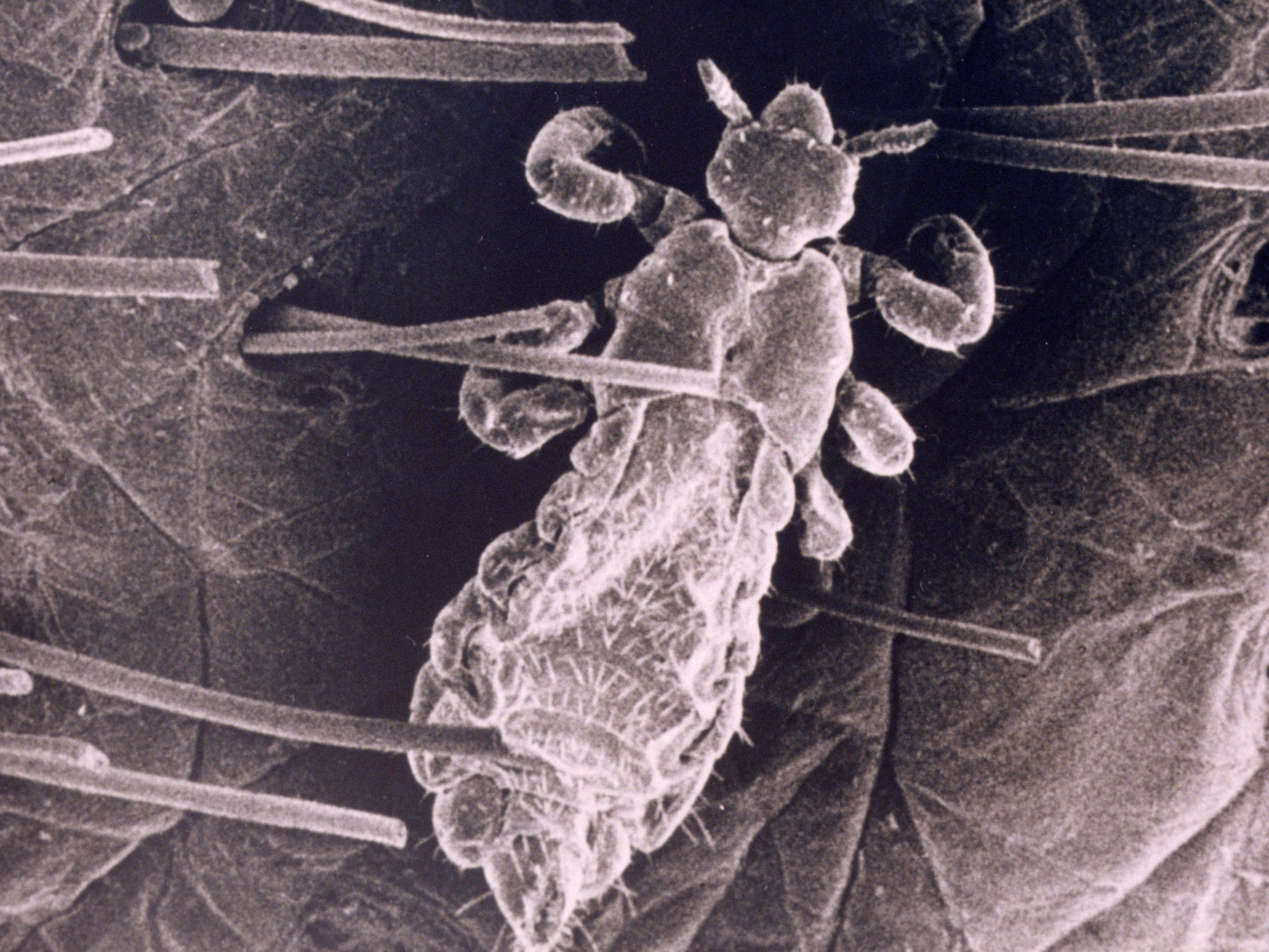 A head louse beneath a microscope