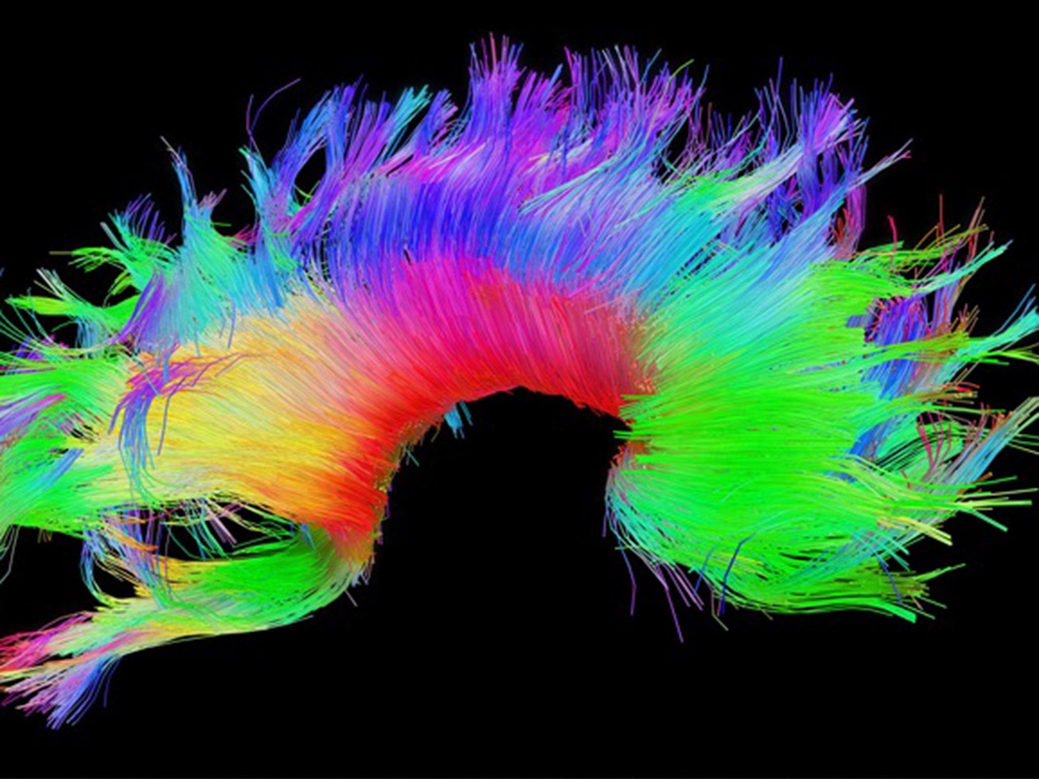 White matter fiber architecture from the Connectome Scanner dataset.