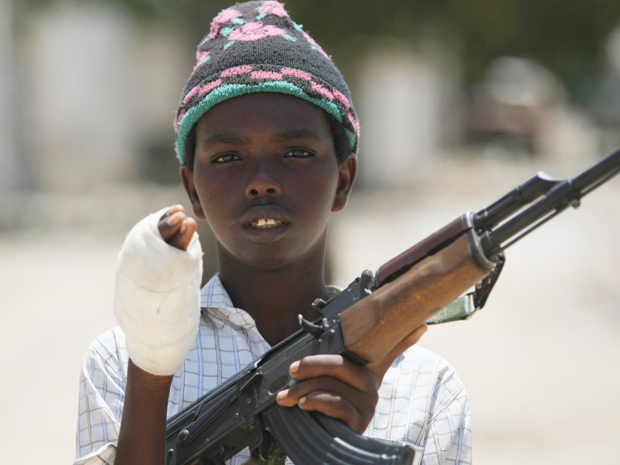 A young fighter from the Al-Shabab militia shows his wounded hand which he suffered while battling Somali government forces in Mogadishu