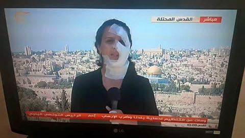 TV reporter Hana Hammad back at work after being hit by a grenade