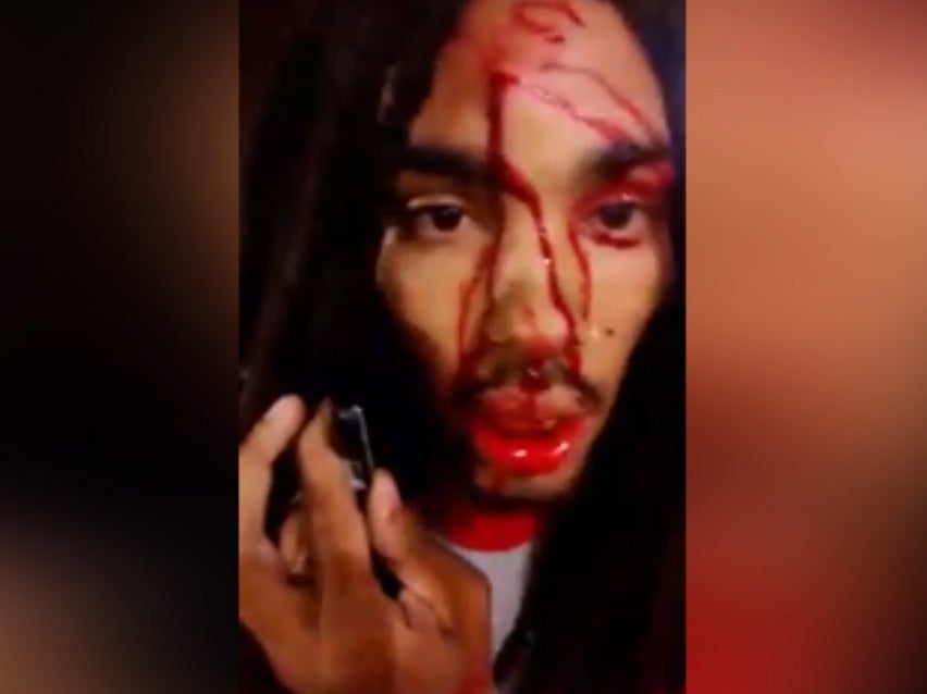 Rapper shot in the head and posts video of immediate aftermath on Facebook