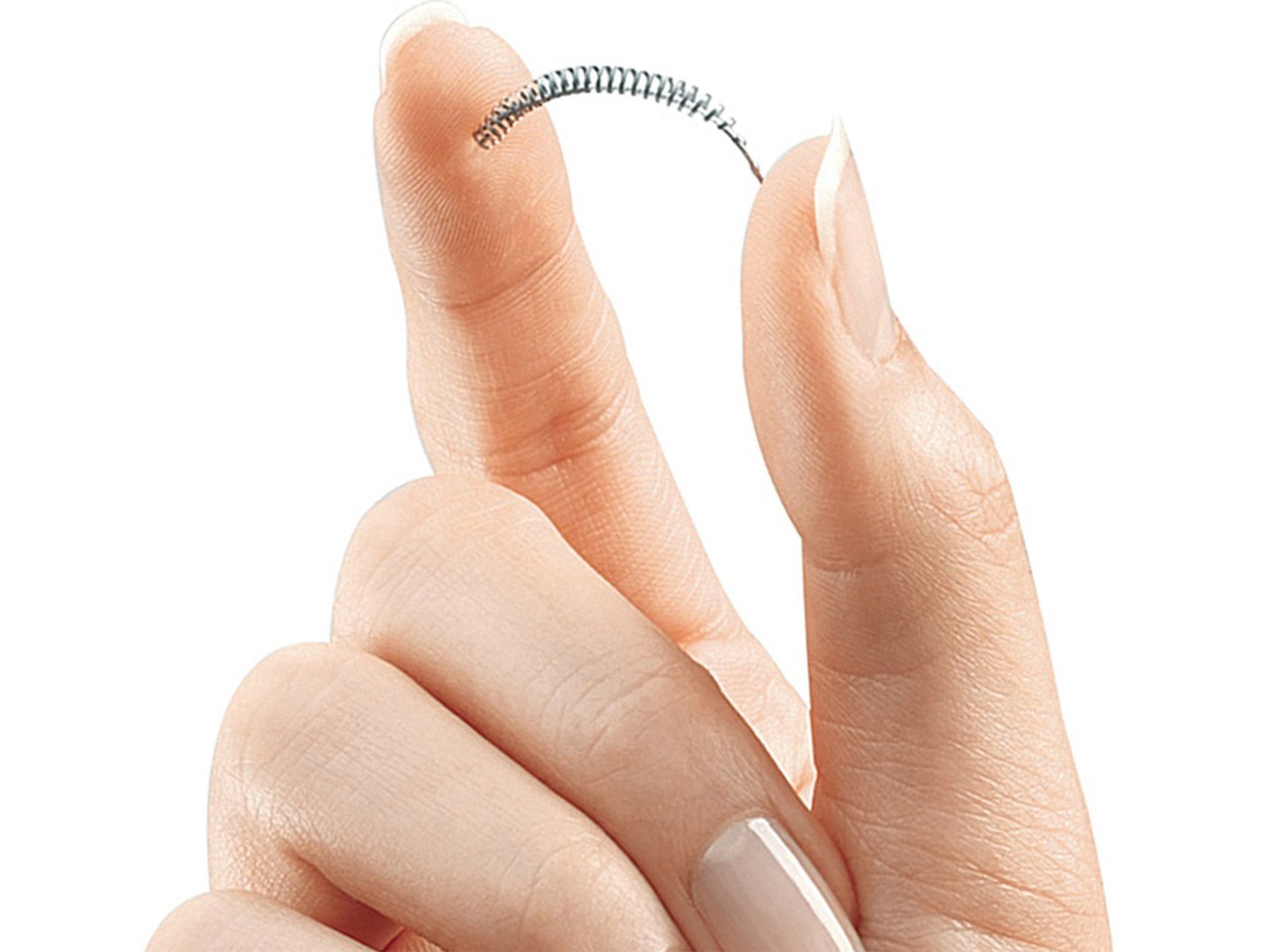 The Essure implant causes the fallopian tube to form scar tissue which eventually blocks the tube