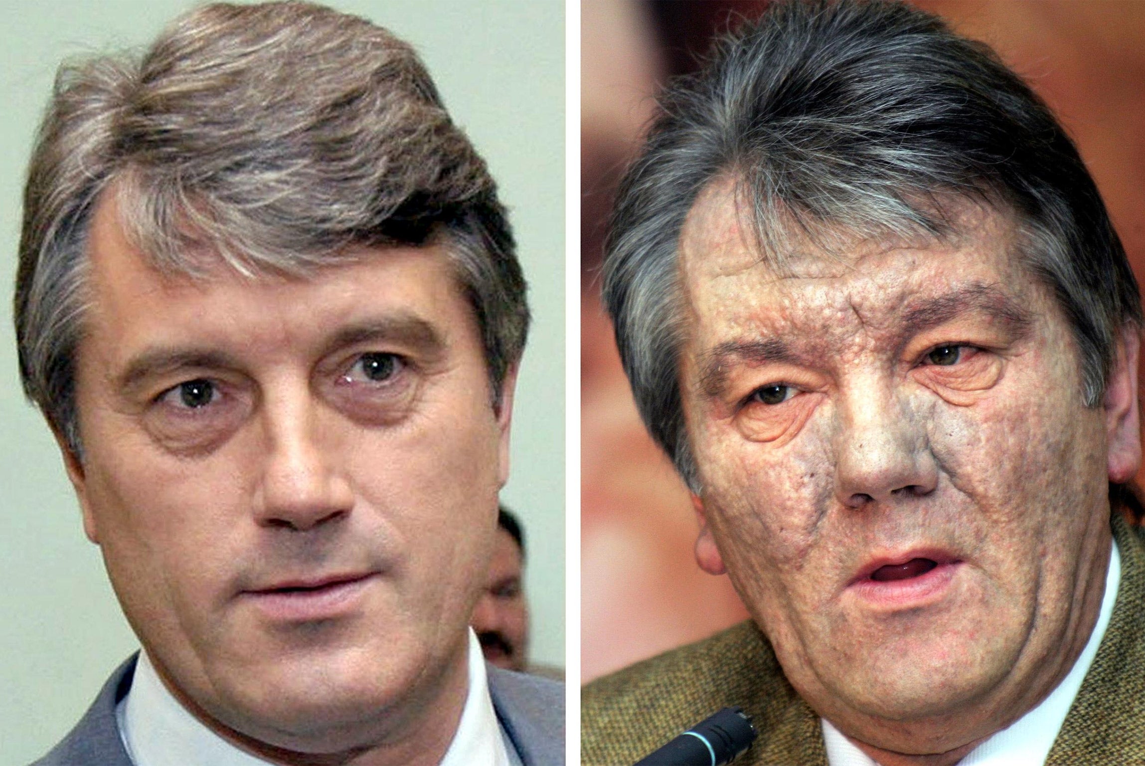 Left, Viktor Yushchenko in July 2004 and, right, later that year. Mr Yushchenko’s doctor disclosed that he was the victim of dioxin poisoning (AFP)