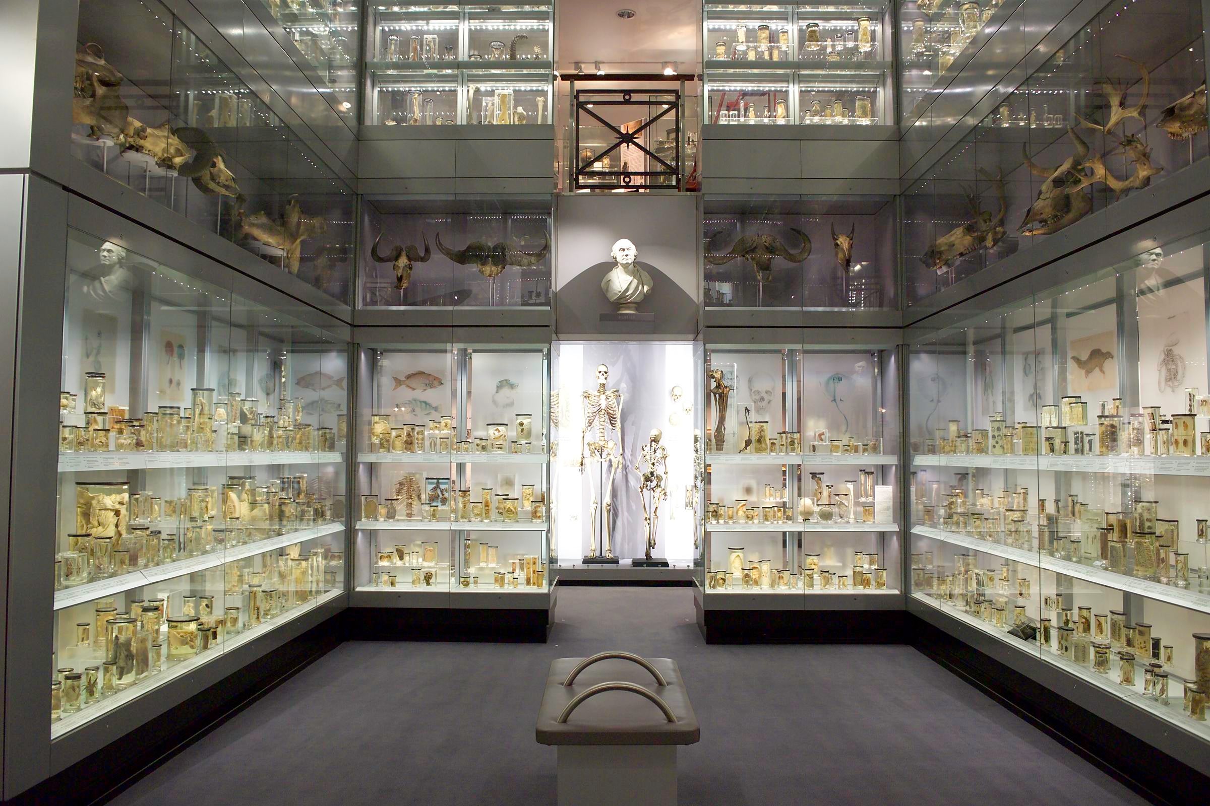 The skull is on display at the Hunterian Museum at The Royal College of Surgeons in London