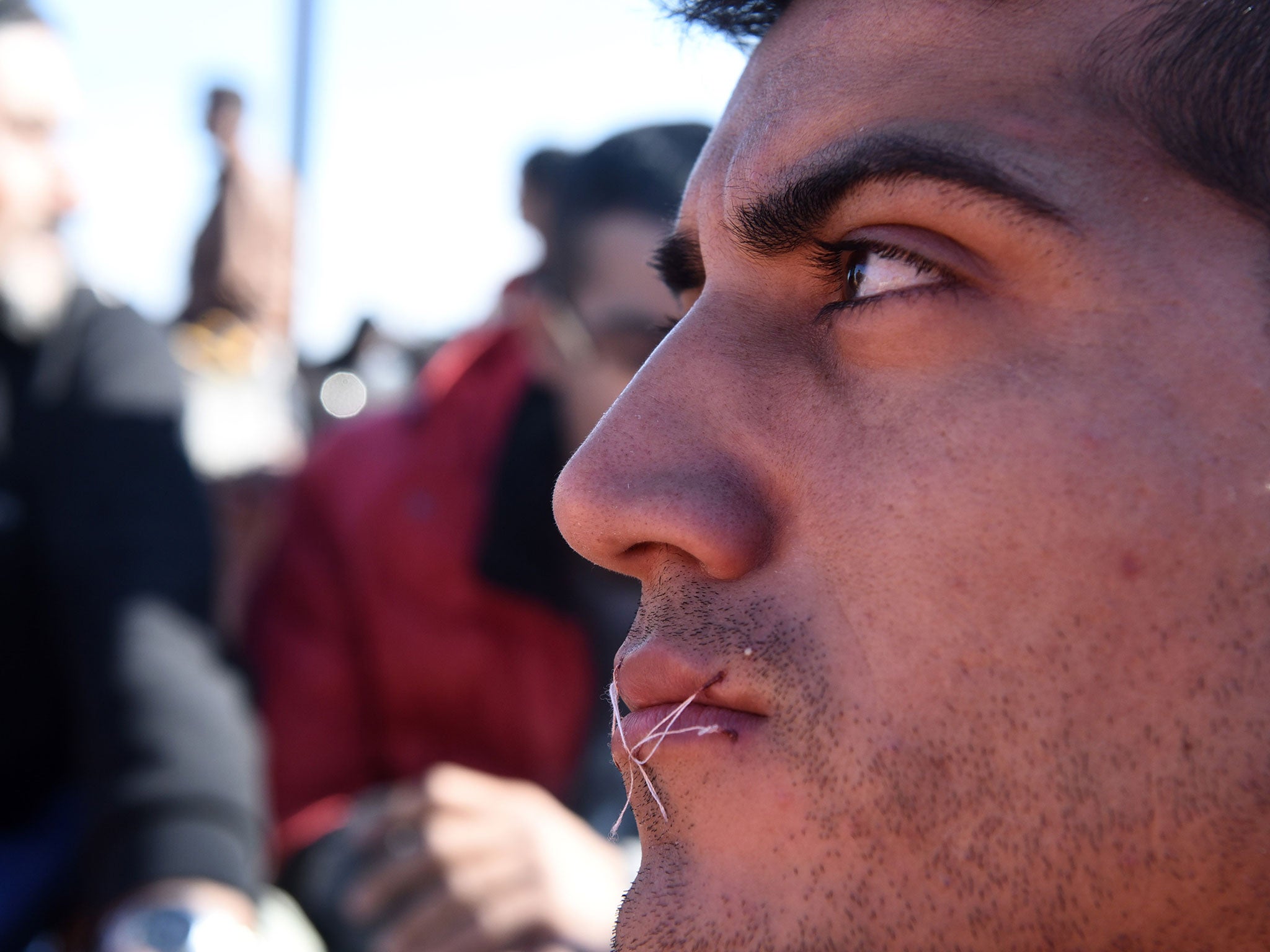 A migrant sits in no-man's land with his mouth sewn shut during a protest near the village of Idomeni at the Greek-Macedonian border, on Monday, Nov. 23, 2015.