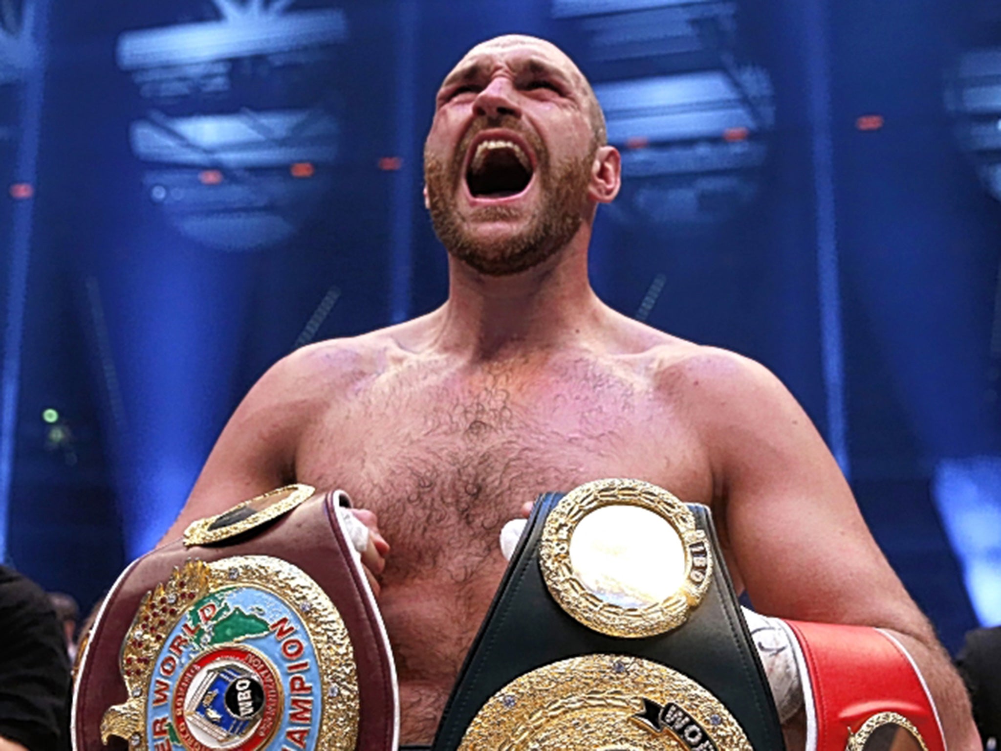 &#13;
Tyson Fury holds his new belts&#13;