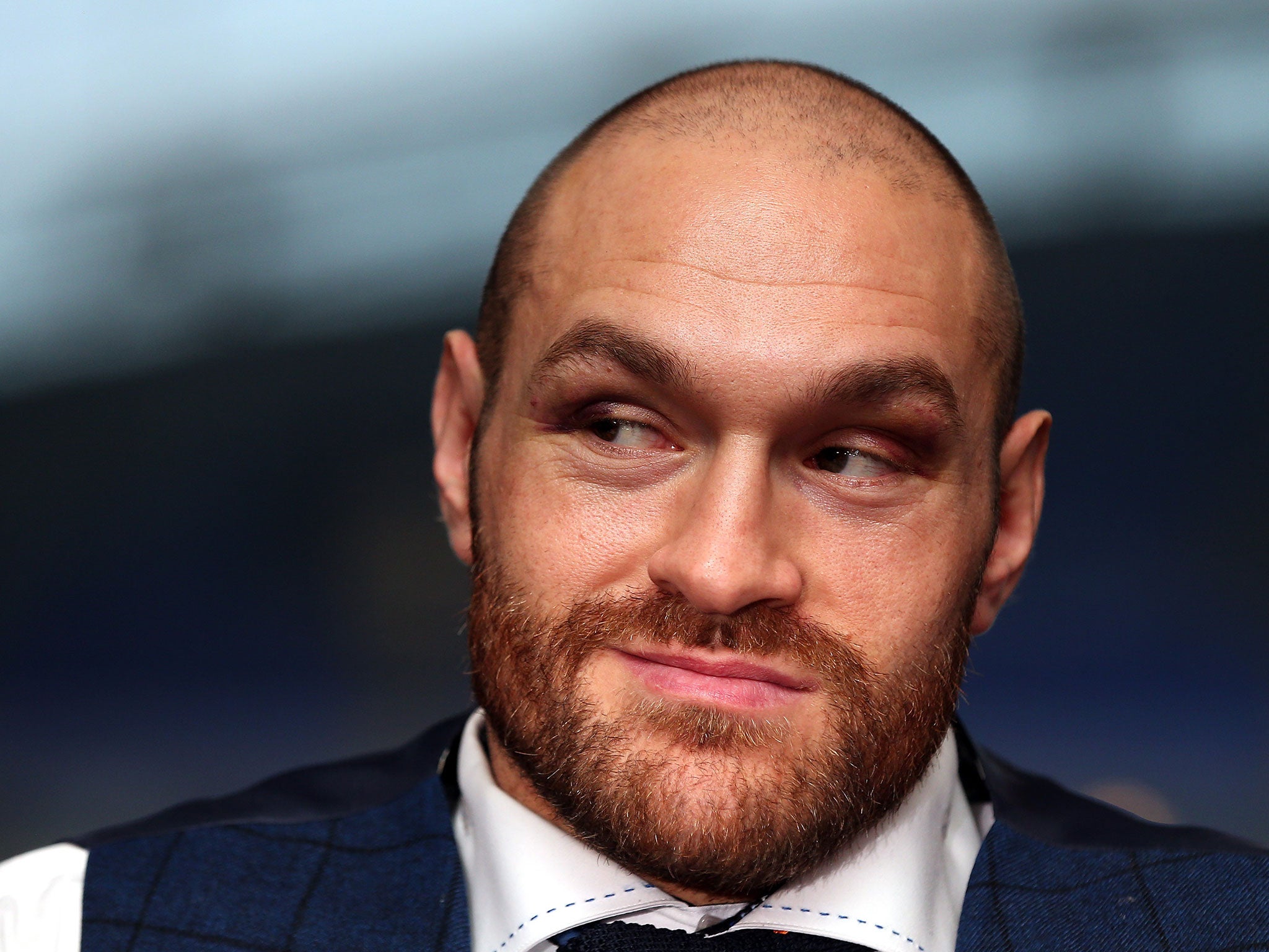 Tyson Fury