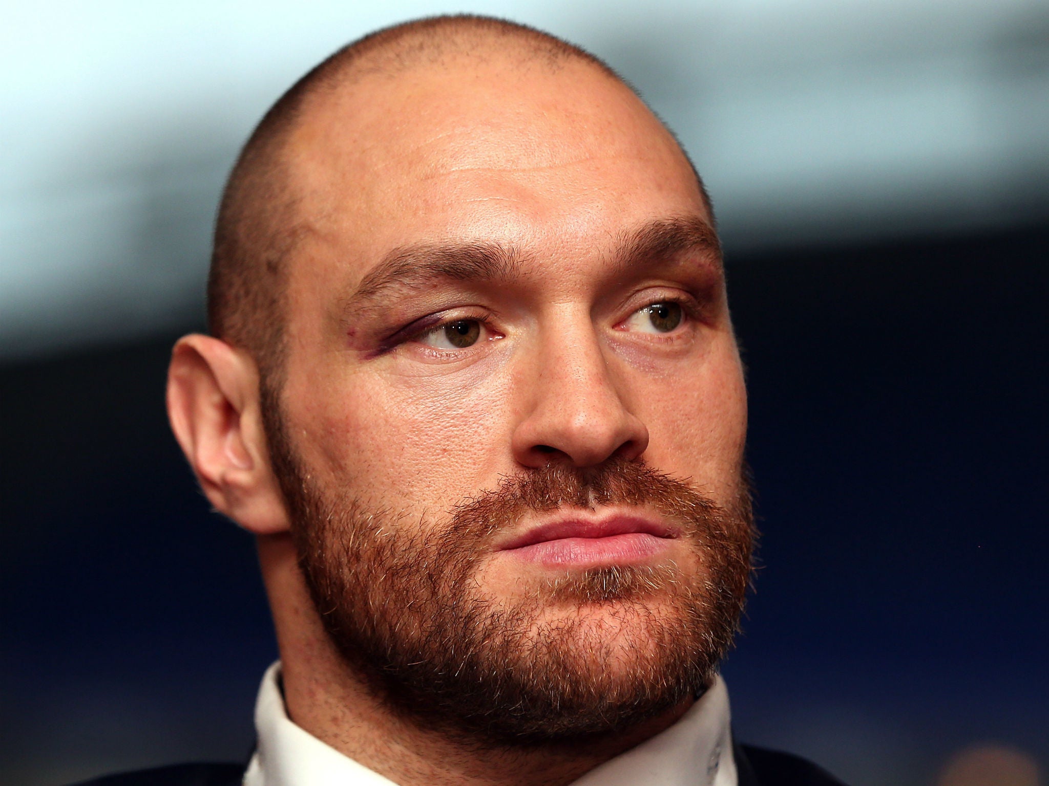 A petition calling for the BBC to remove Fury from the SPOTY shortlist has amassed over 120,000 signatures