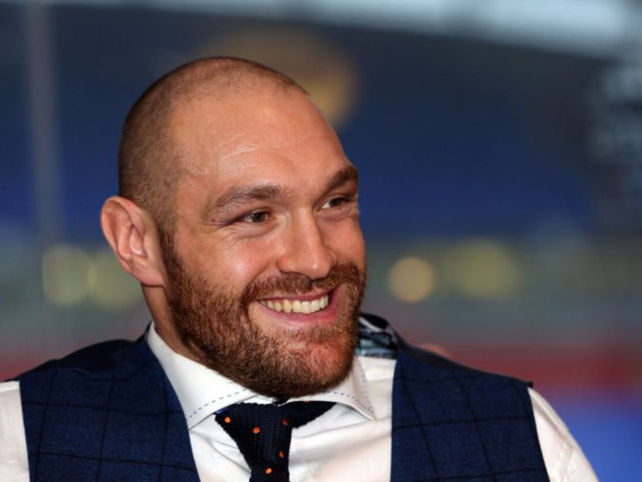 World boxing champion Tyson Fury’s personality is not to everyone’s taste