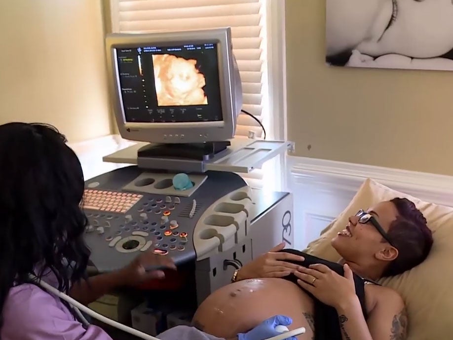 Alexis attends a baby scan Youtube