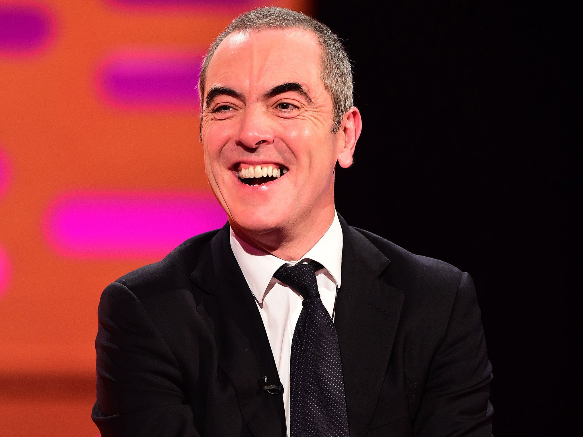 Nesbitt appeared on The Graham Norton Show last week with a much thinner hairstyle