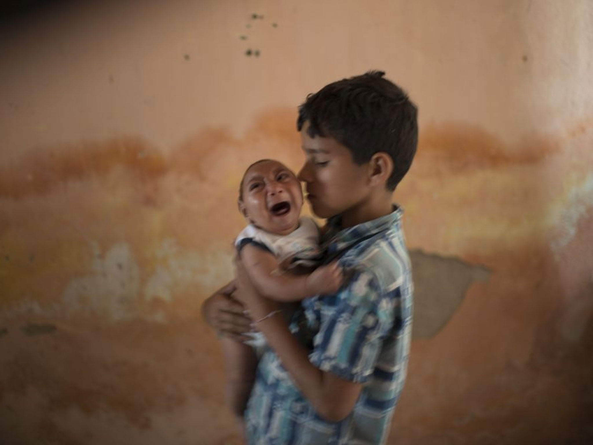 A baby with microcephaly cries in Brazil