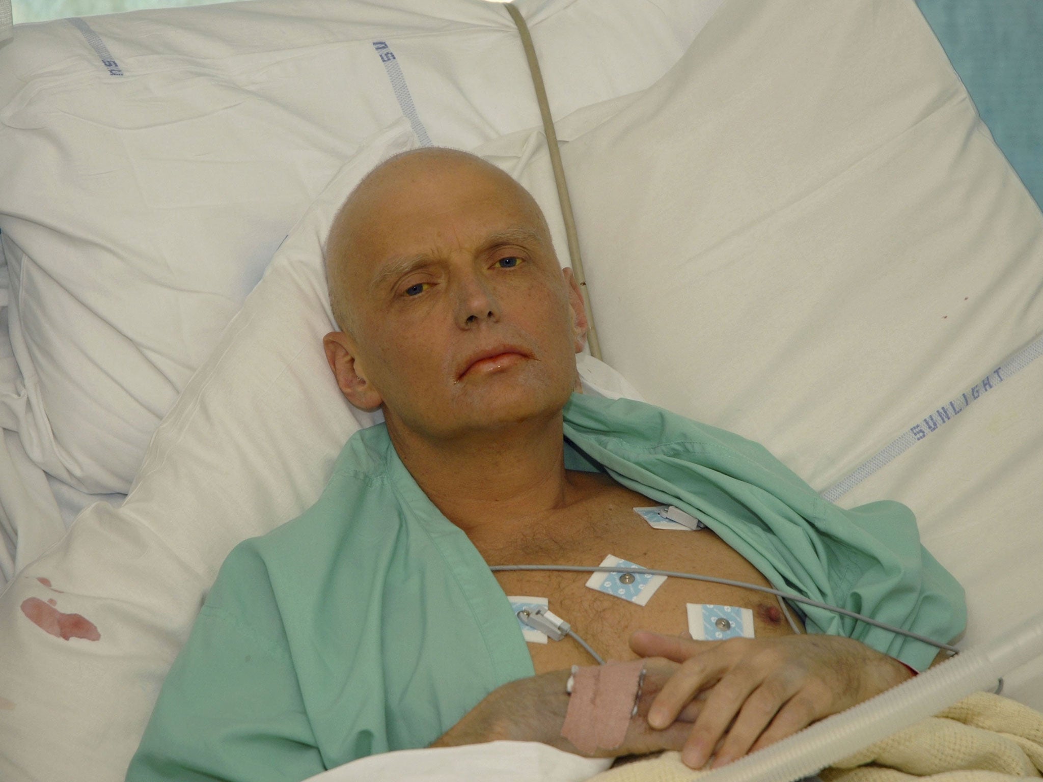 Alexander Litvinenko at the Intensive Care Unit of University College Hospital