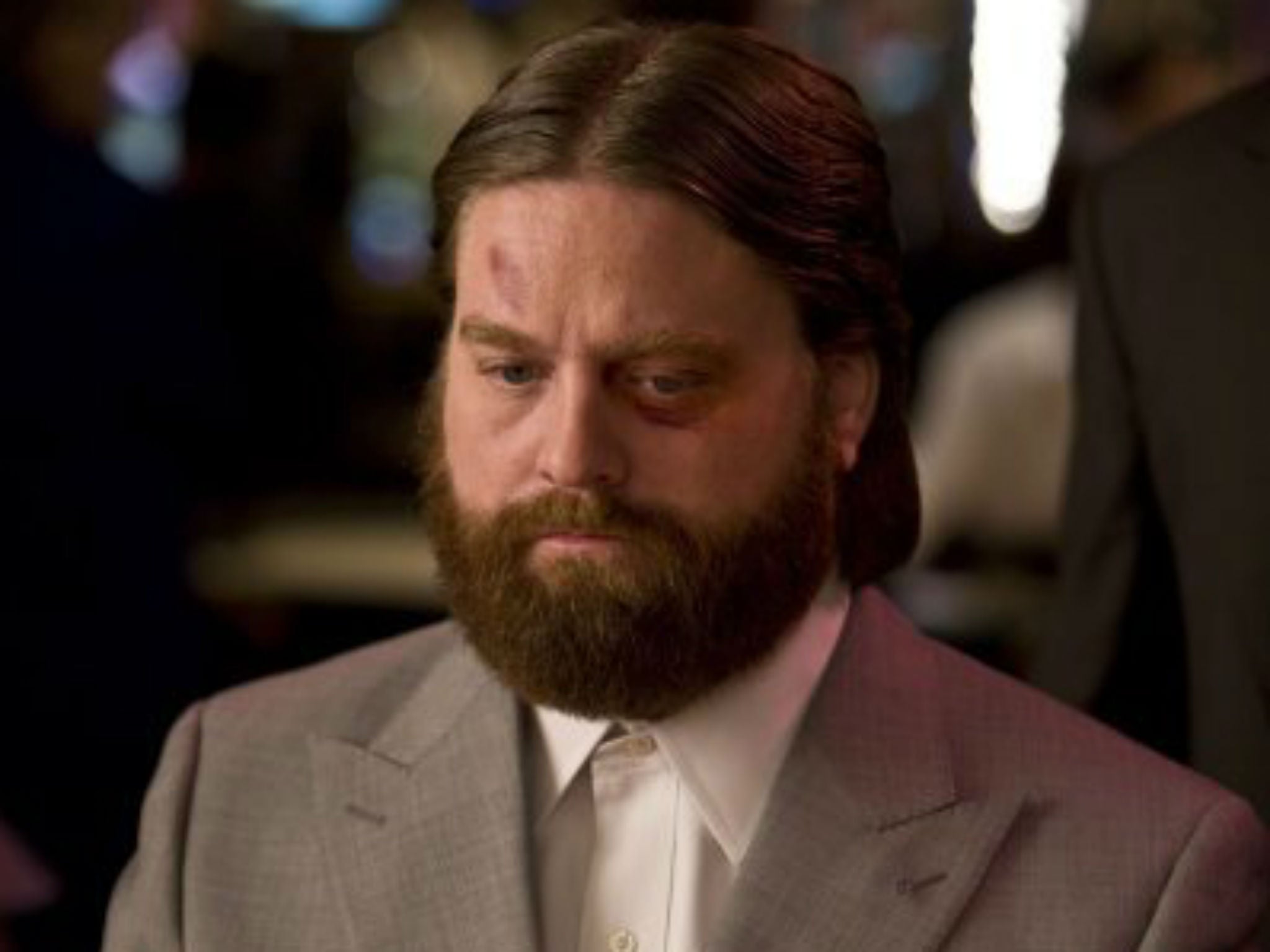 Zach Galifianakis as Alan in 2009's The Hangover