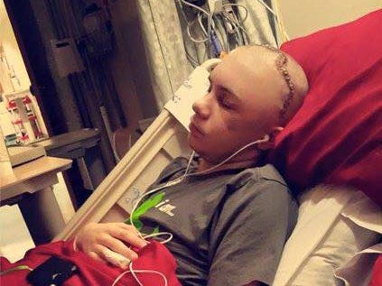 Fourteen-year-old Skylar Fish suffered severe head injuries after his attempt at the challenge went awry