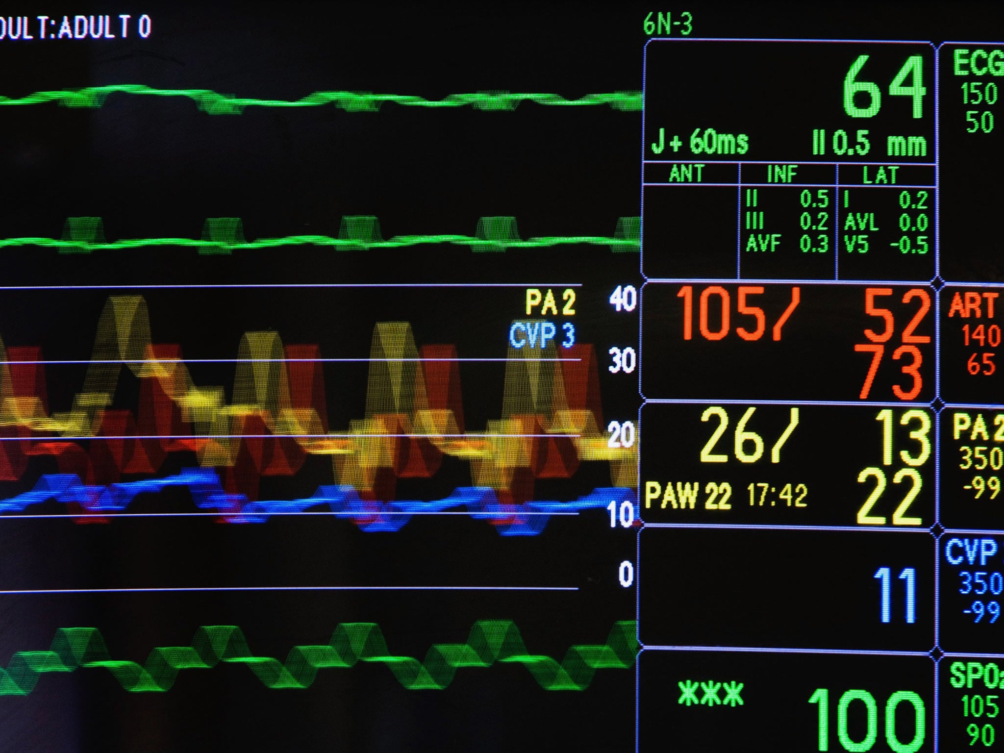 Global remains on life support, stable but with its future uncertain