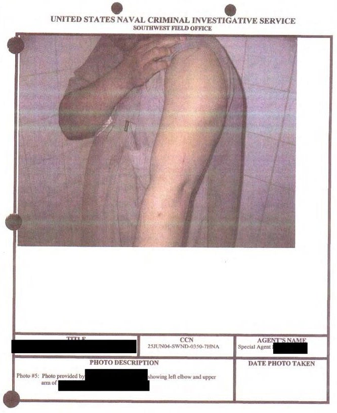 An alleged prisoner showing his arms in an evidence photo at an unknowen location