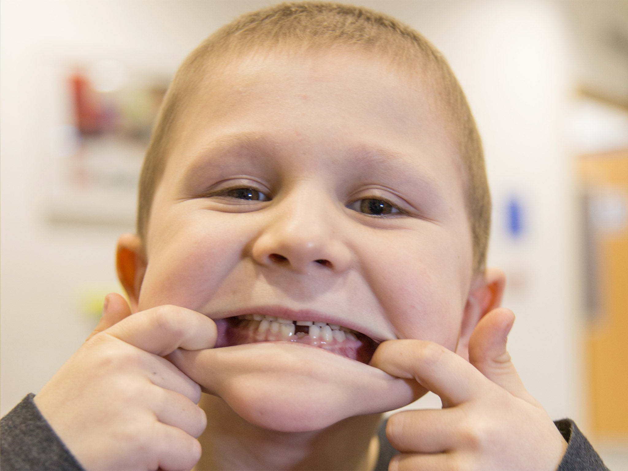 Rowan Pethard is back at school for four days a week after treatment for leukaemia at GOSH