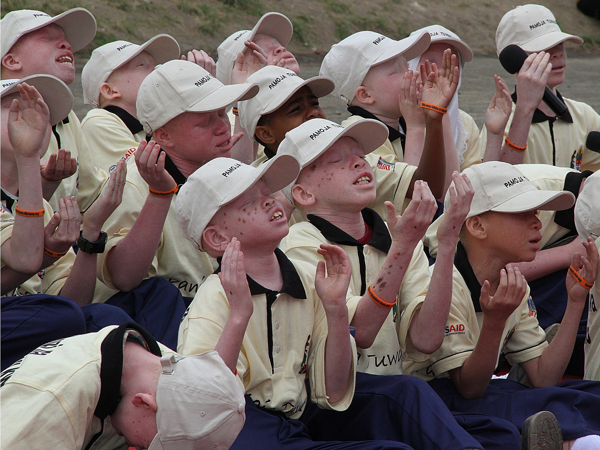 Albino children in neighbouring Tanzania, where their body parts are in high demand