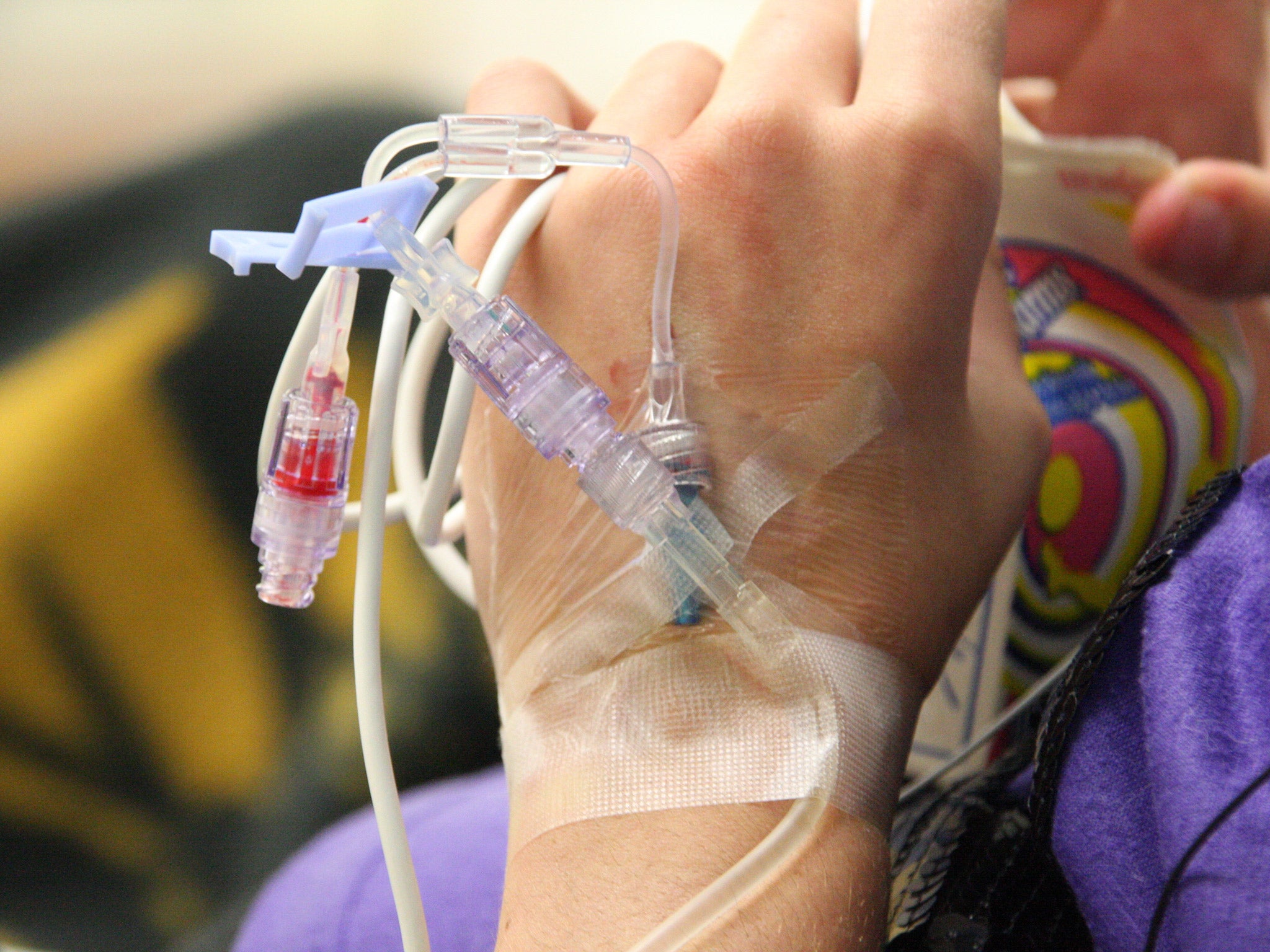 A young girl receiving chemotherapy. There is a 5% mortality rate resulting from conventional treatment, with toxically high doses of drugs