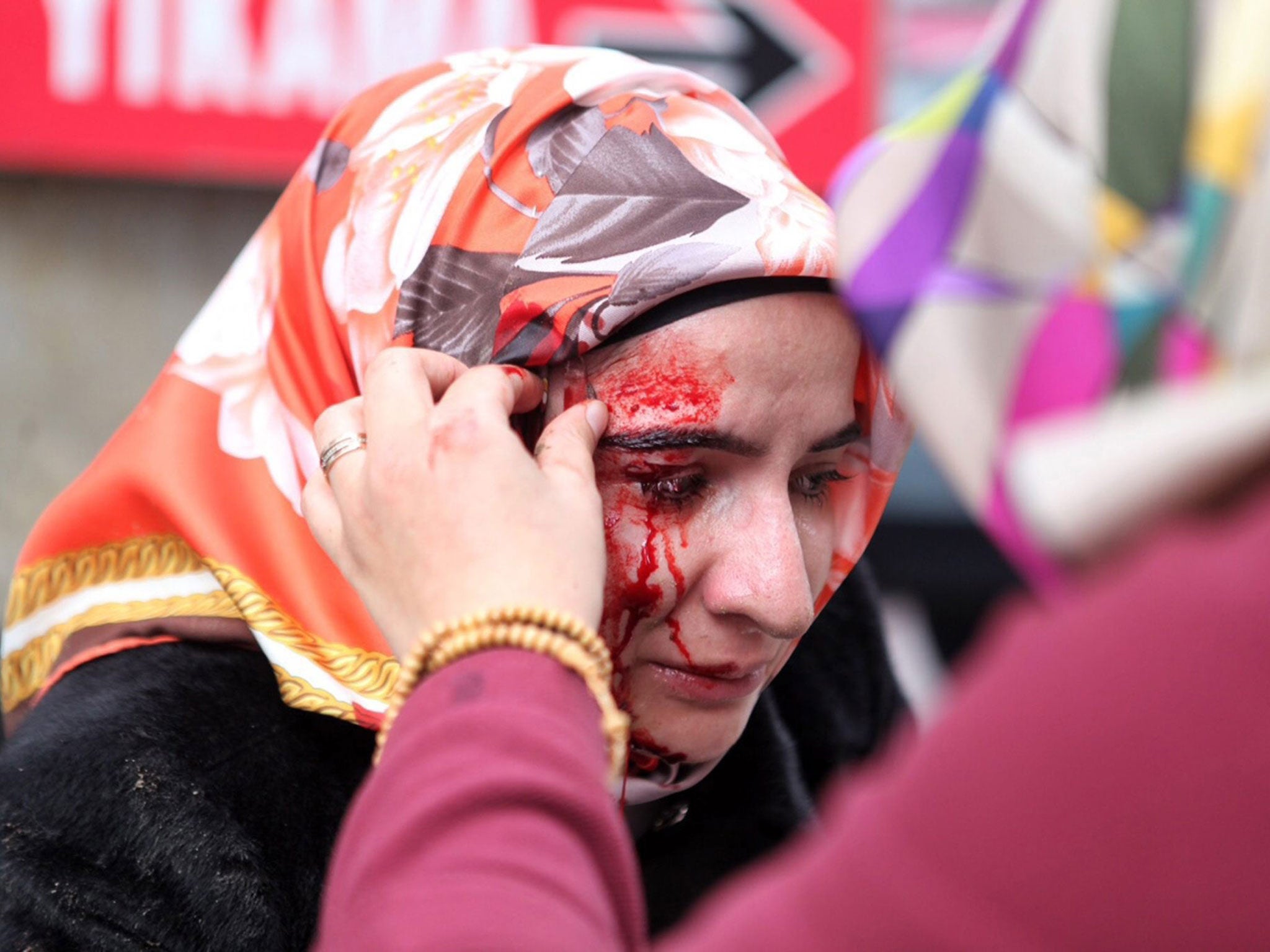 A wounded protester being helped by her friends after Turkish riot police dispersed them during a protest outside of Zaman newspaper building, in Istanbul, Turkey, 05 March 2016.