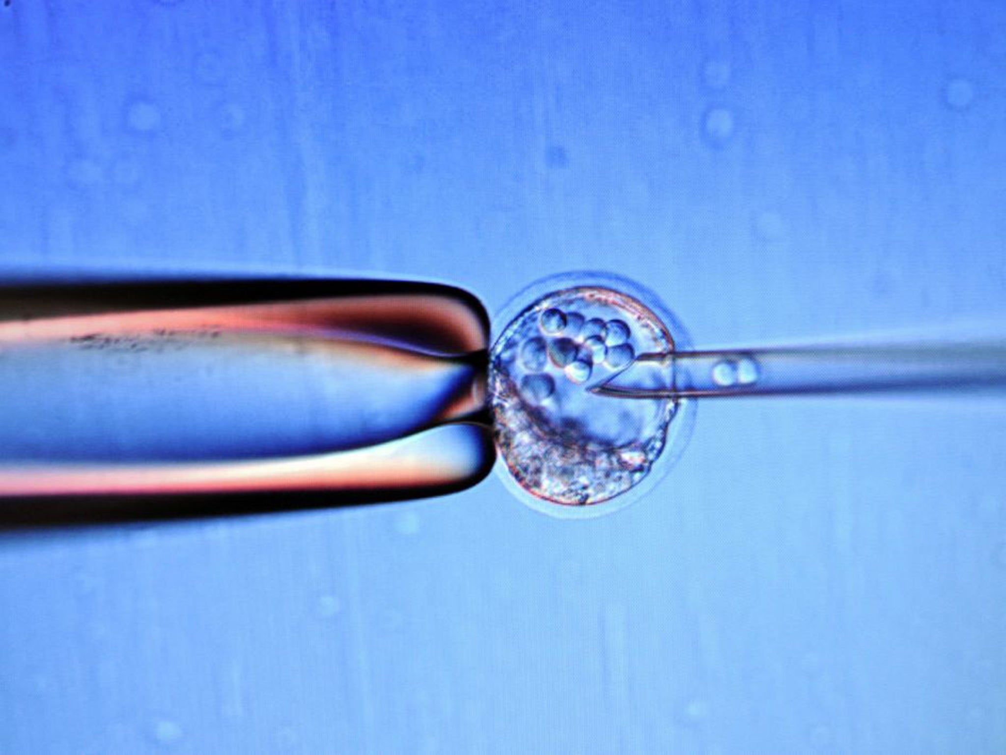 &#13;
Embryo stem cells &#13;