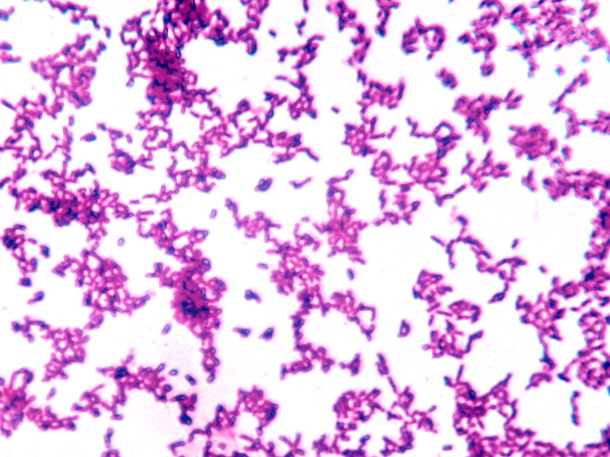 The Shigella dysenteria microbe produces a powerful toxin known as Shiga, named after the Japanese doctor who first identified it in 1897