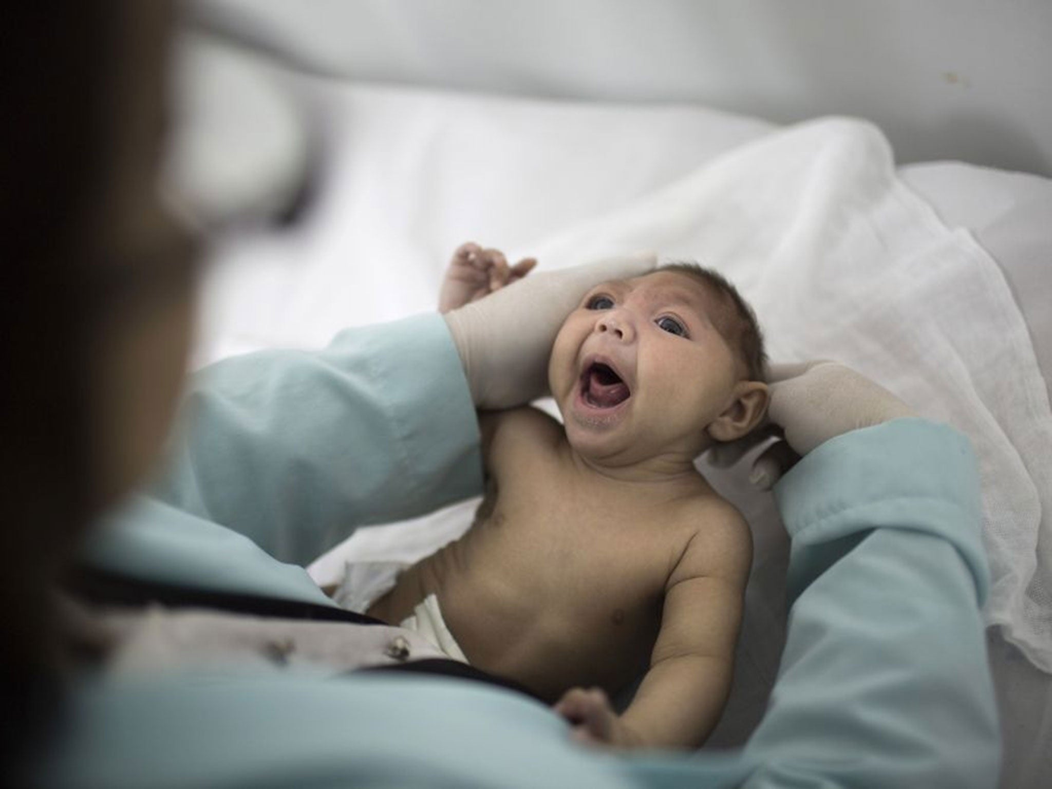 A three-months-old baby born with microcephaly, is examined by a neurologist at the Pedro I hospital in Campina Grande, Brazil