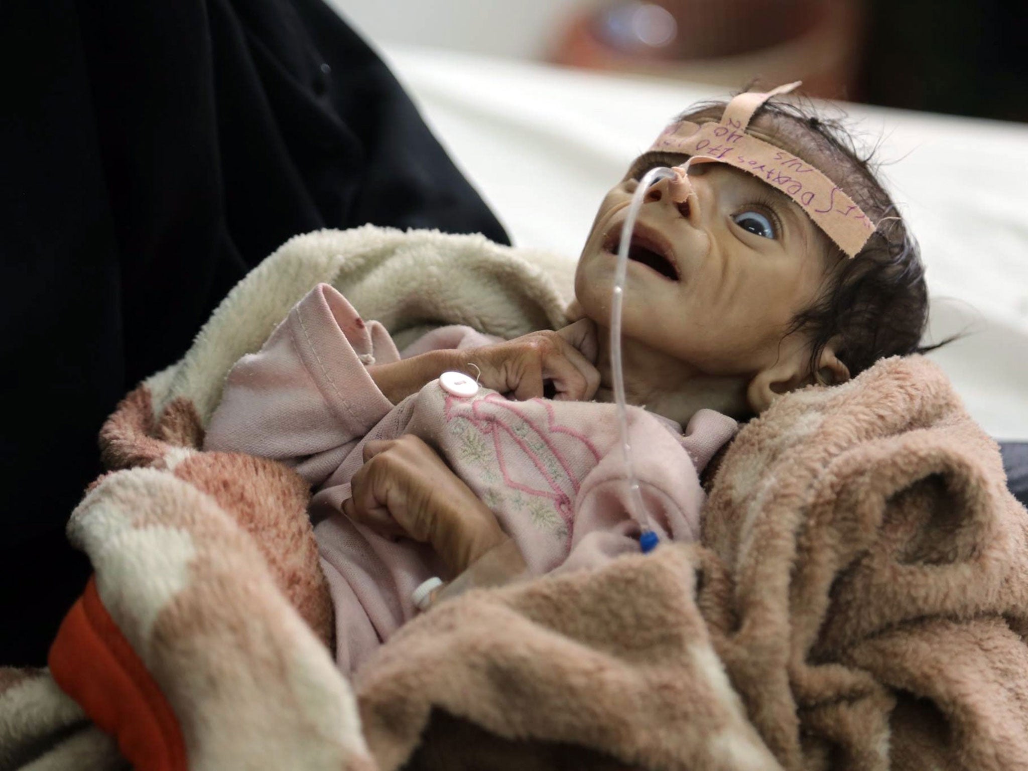 Udai Faisal, who is suffering from acute malnutrition, at Al-Sabeen Hospital in Sanaa, Yemen, two days before his death on 24 March