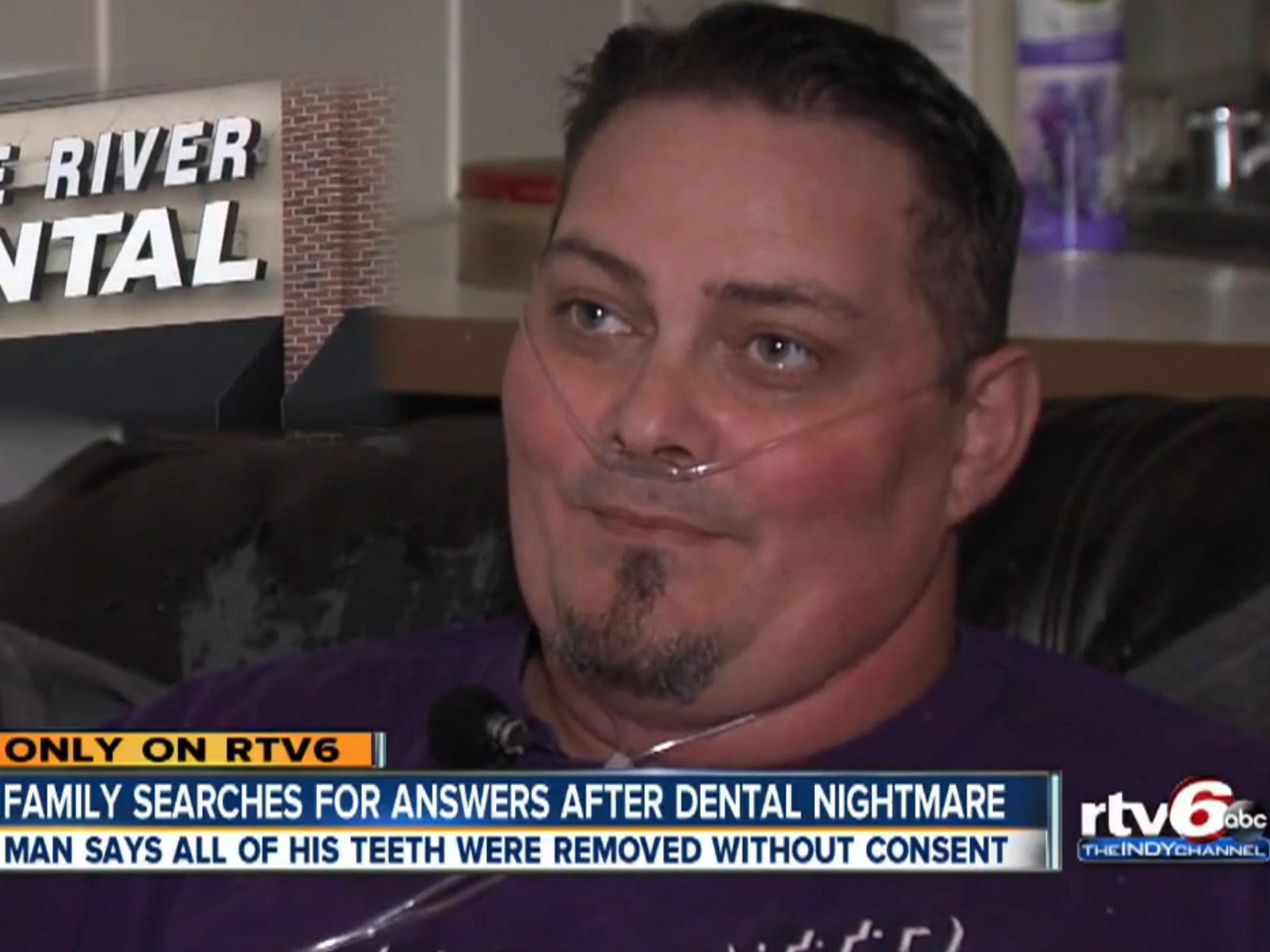 Donny Grigsby woke to find all of his teeth had been removed