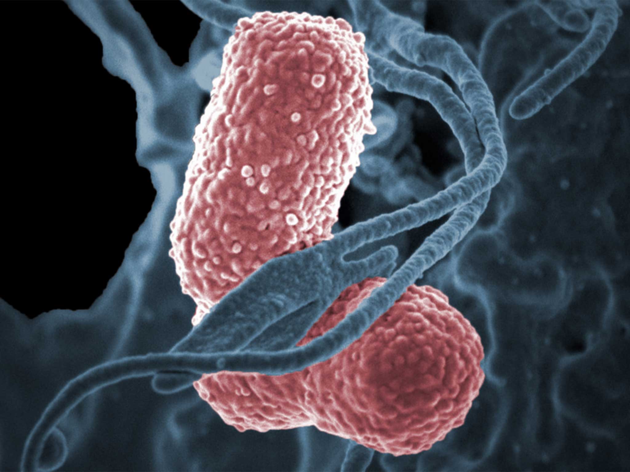K. pneumoniaeis one of the toughest super-infections