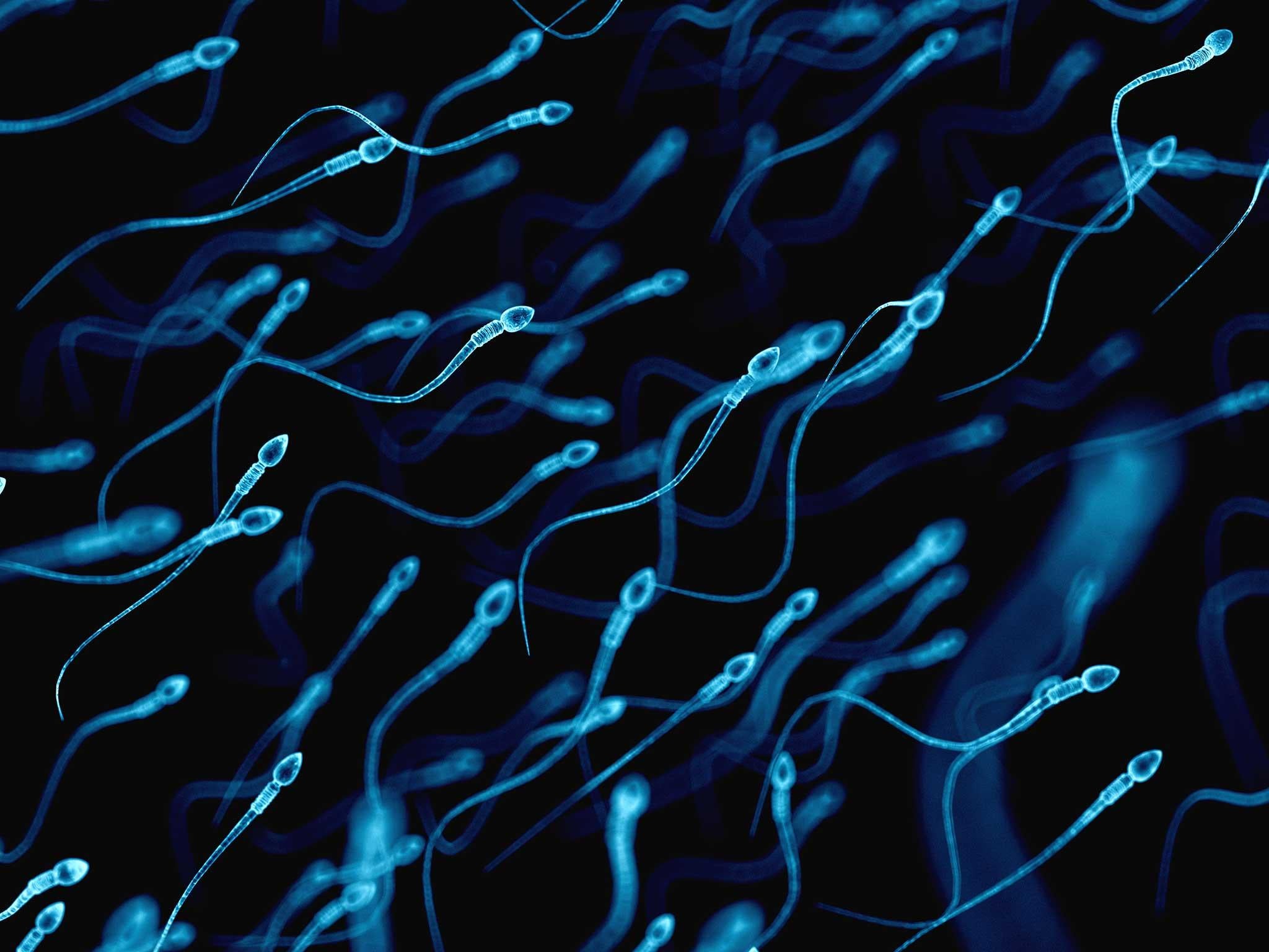 Medically accurate illustration of human sperm cells