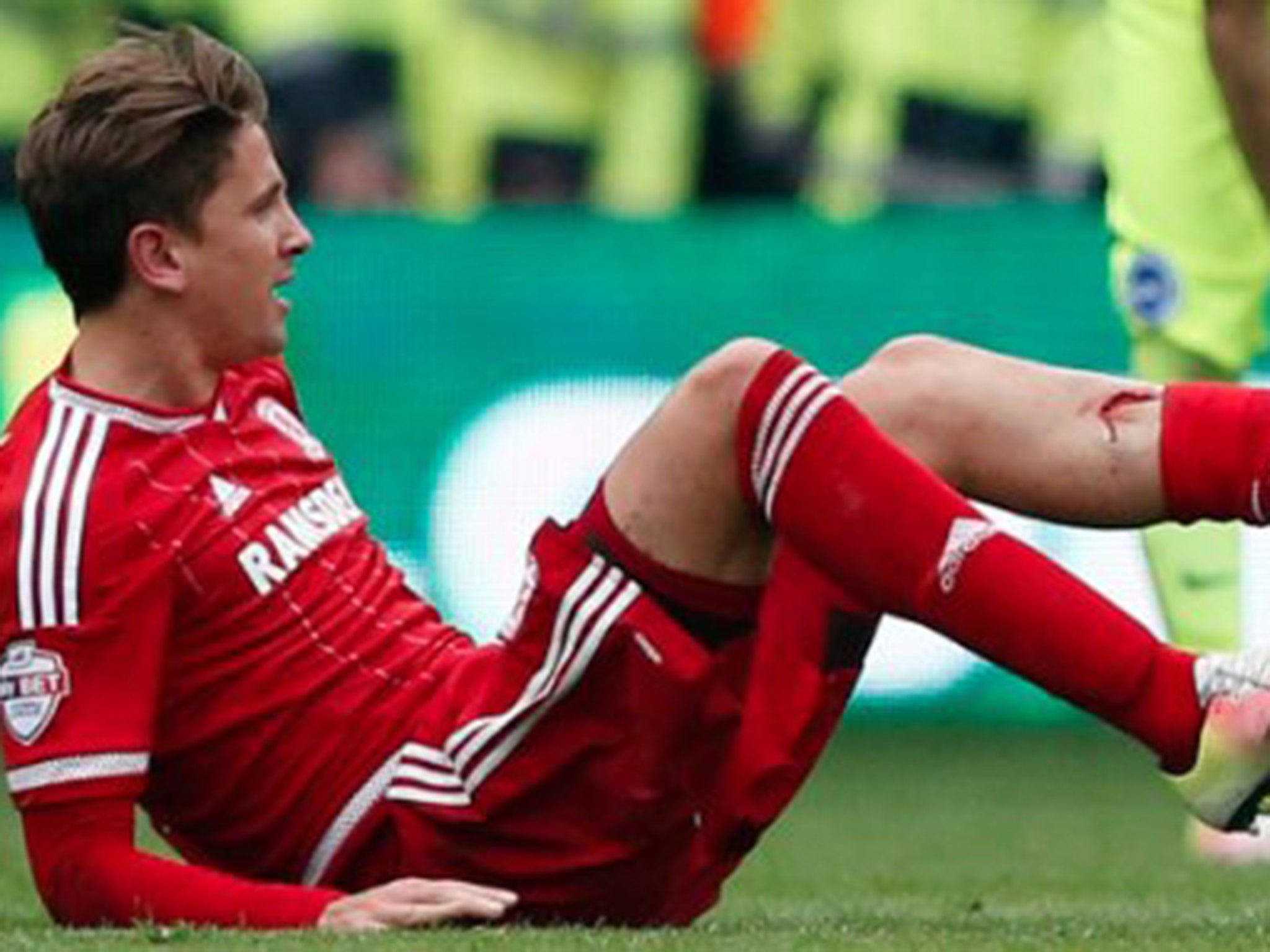 Ramirez suffered a gash on his shin during Middlesbrough's 1-1 draw with Brighton