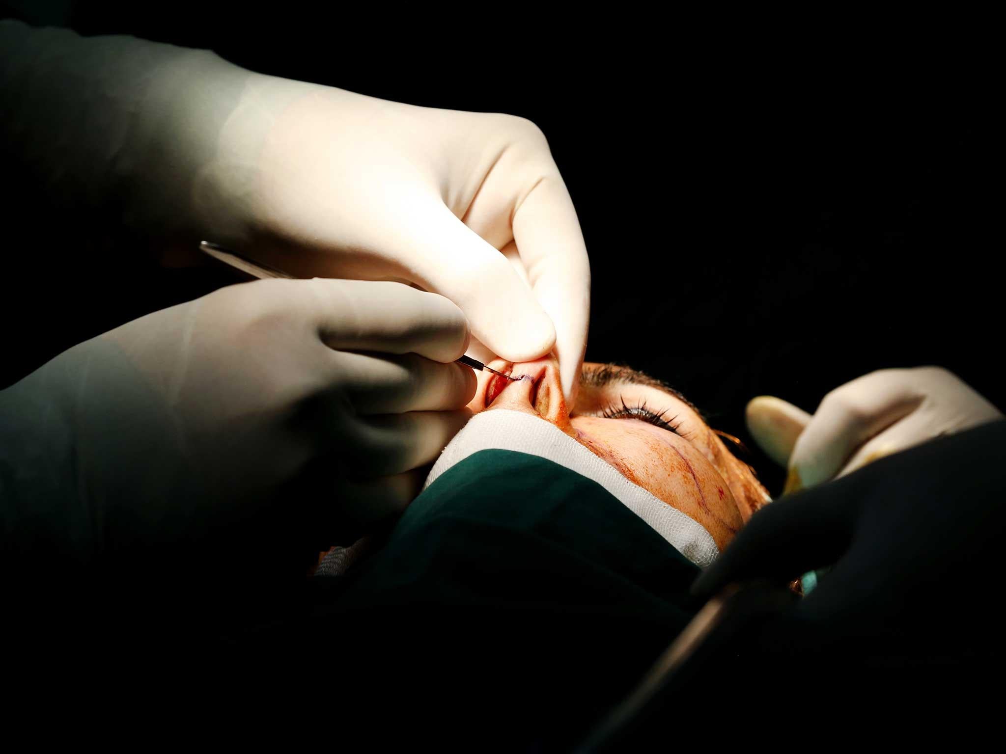 Of the 40,000 annual cosmetic procedures in Iran, more than 60 per cent are nose jobs