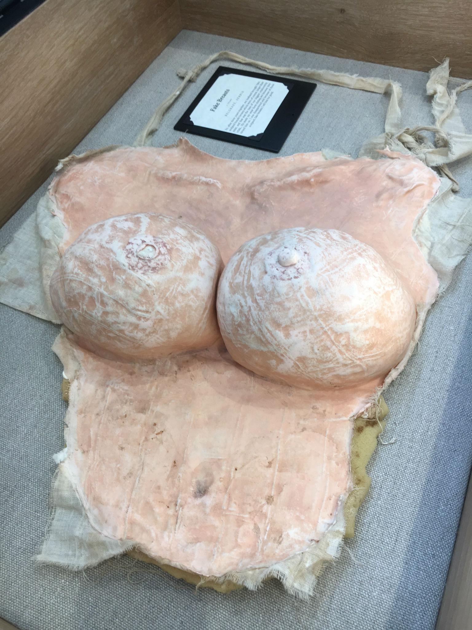 These fake, sculpted breasts were donated by a woman in Belgrade, Serbia, whose husband urged her to wear them during sex. She left him instead.