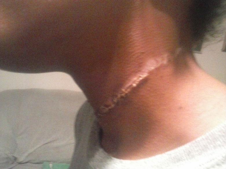 The girl suffered 'severe and painful' cuts on her neck from the rope