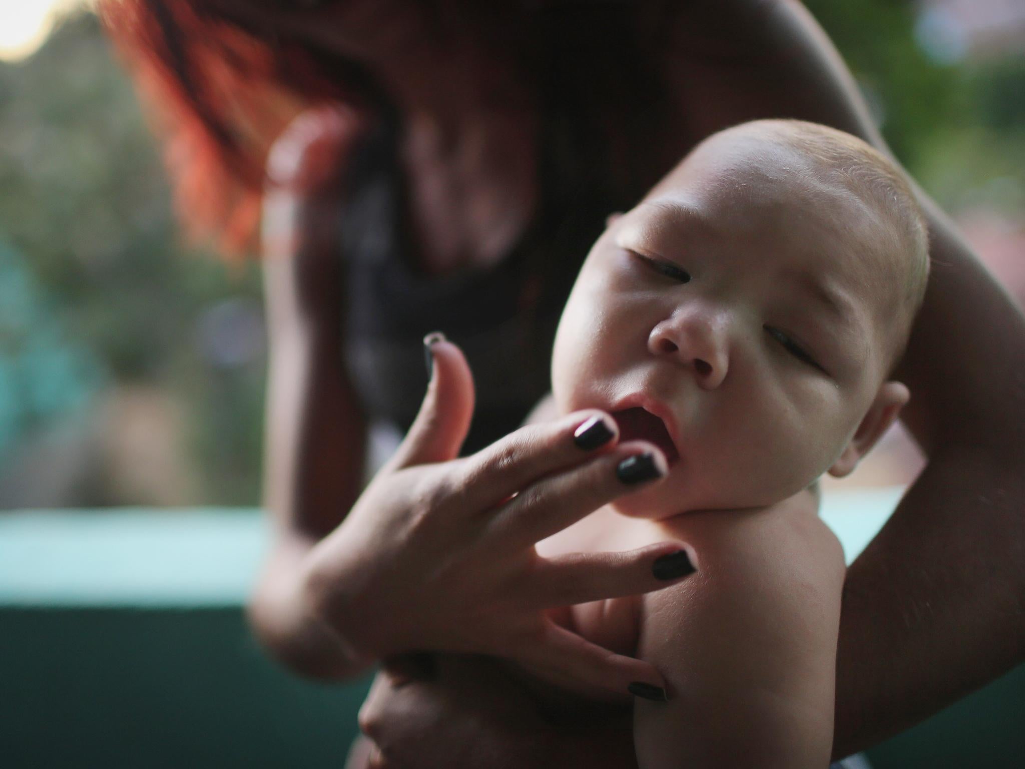 Babies with microcephaly are born with abnormally small heads (file photo)