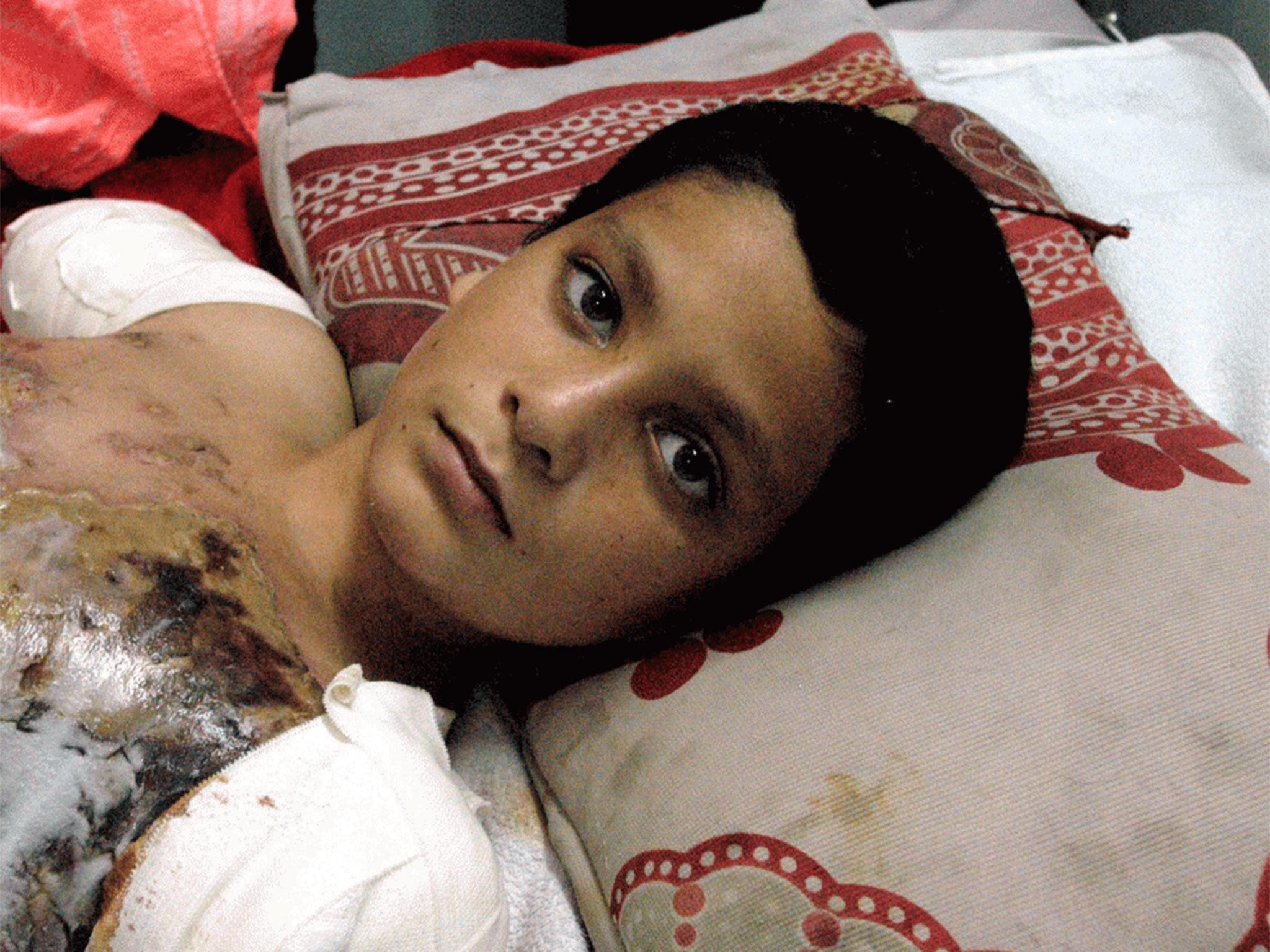 Ali Abbas, aged 12, in an Iraqi hospital in 2003