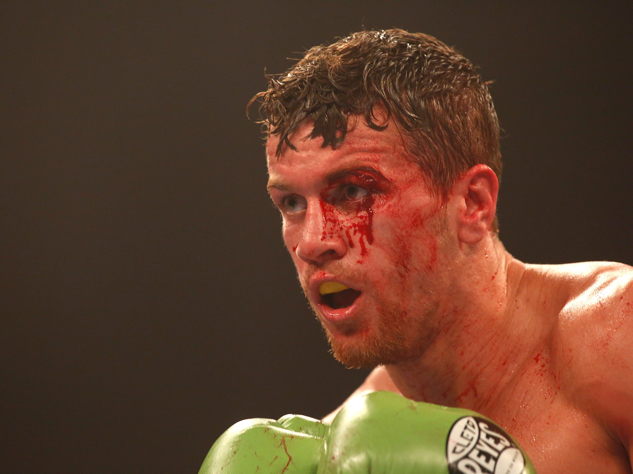 Corcoran with his bloody left eye, cut in round four