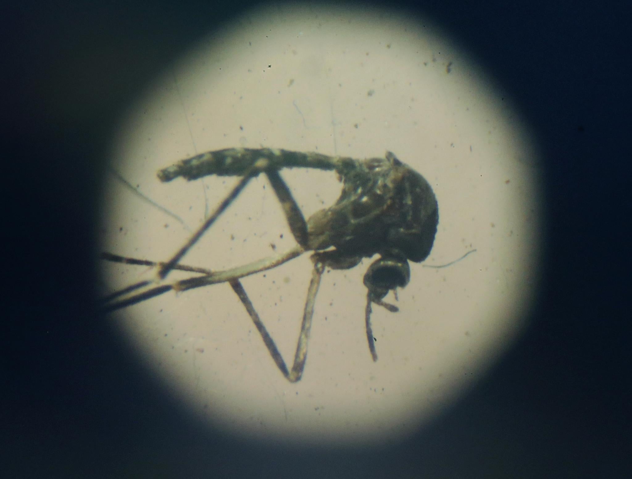 An Aedes aegypti mosquito is seen through a microscope at en exhibition on Dengue fever on January 28, 2016 in Recife, Pernambuco state, Brazil. The mosquito transmits the Zika virus, as well as Dengue (Mario Tama/Getty Images)