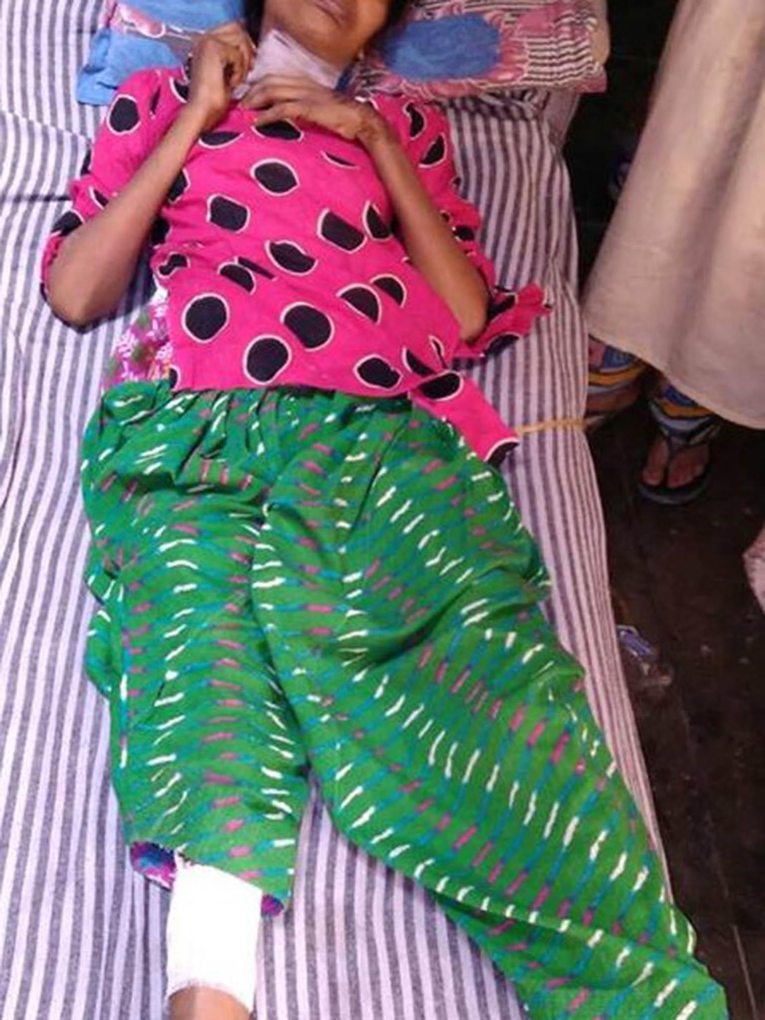 Mukta recovering in hospital in India after she was found in the jungle when she had been dumped