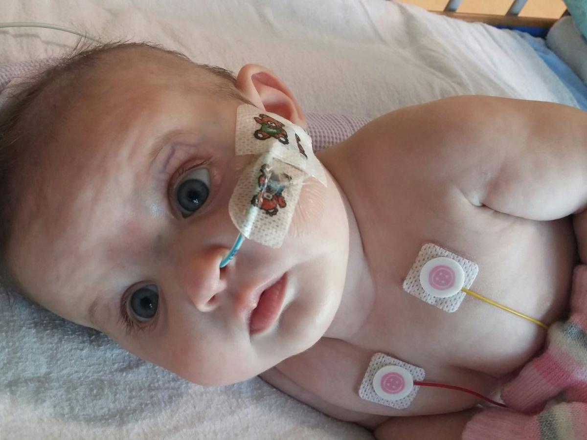 Marnie, who is 20-weeks-old, was born with a severe heart defect