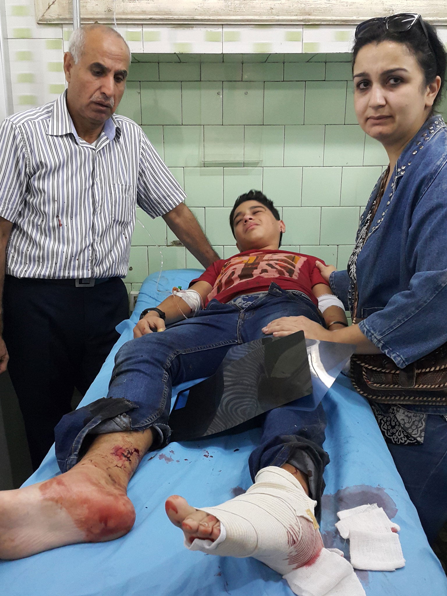 Ahmed Skeifeh, 14, wounded in the legs when a shell hit his school in western Aleppo