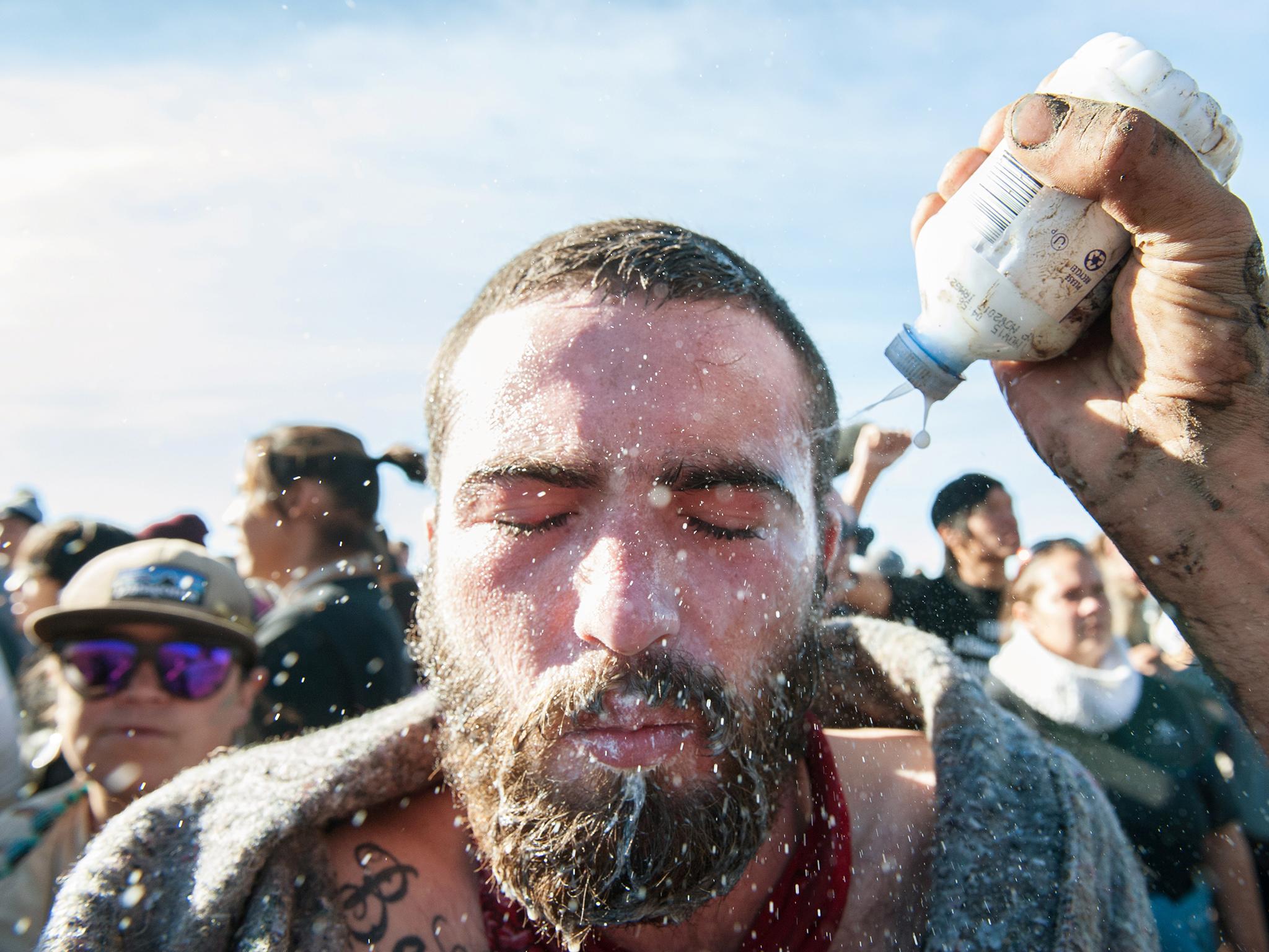 A person pours a pepper spray antidote into a protester's eyes during a protest