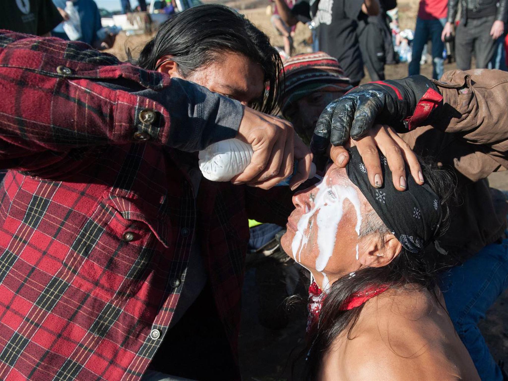 A person pours a pepper spray antidote into a protester's eyes during a protest