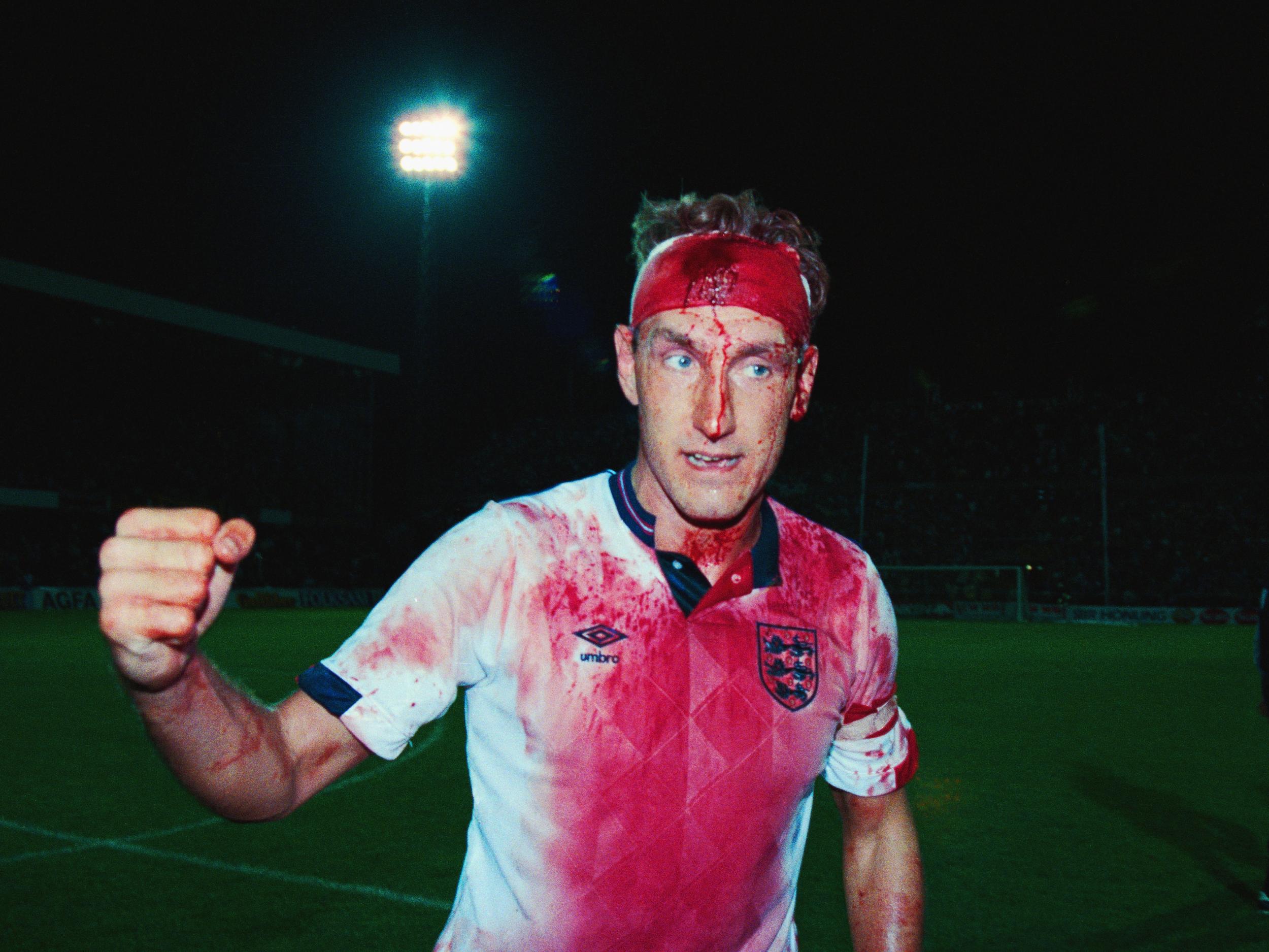 Butcher famously played on with a blood-soaked head wound