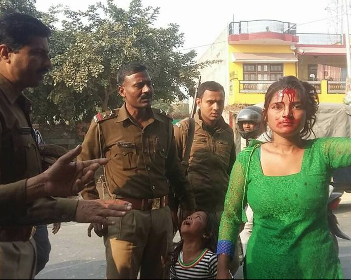 Victim is shown bleeding from the head is shown bleeding while her young daughter cries