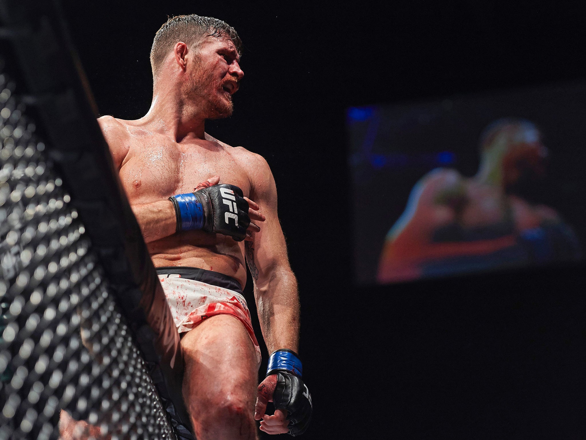 Bisping has more than one option for his next defence