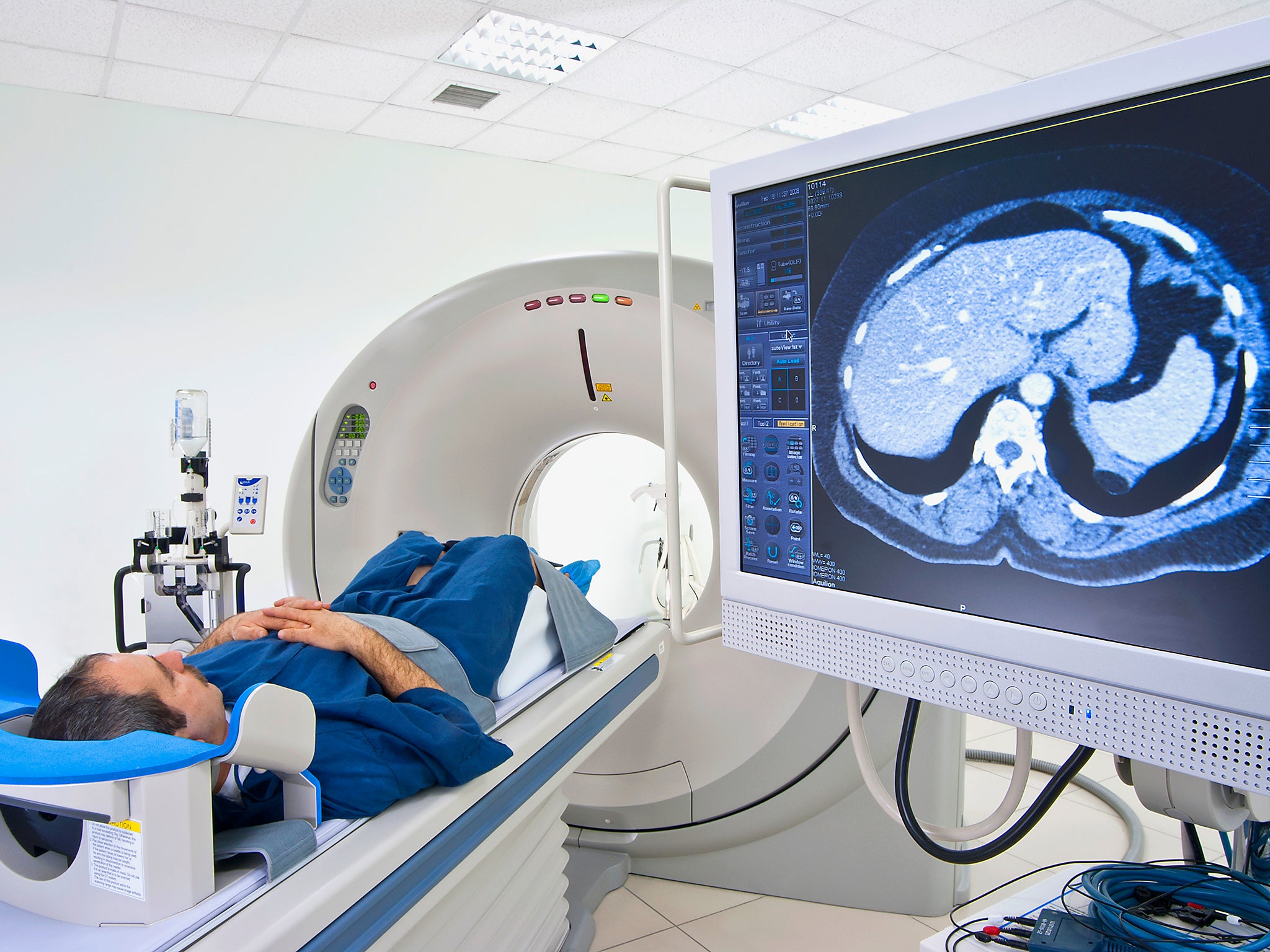 ‘In the past, I would have required an unpleasant bone marrow biopsy for diagnosis. Now all that is required is the wonder of a PET scan’ (Getty/iStock)