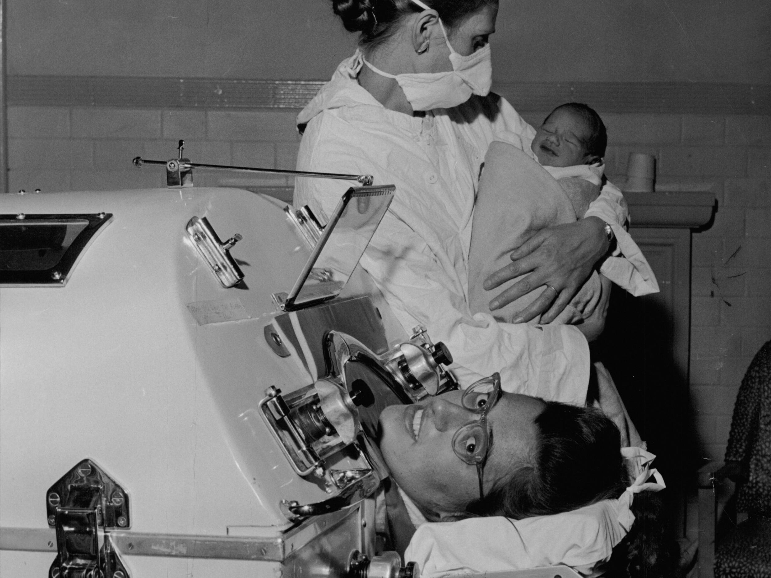 Dawn Varma, who gave birth while inside an iron lung at the age of 20 (Rex)